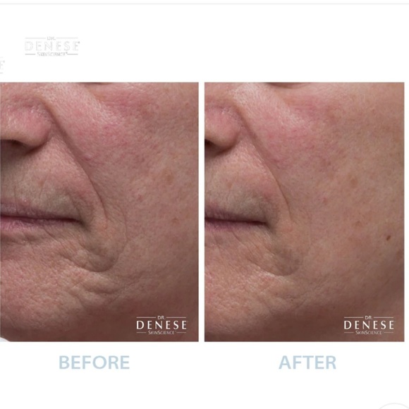 DR. DENESE COLLAGEN FIRMING PEEL OFF MASK 4 fl oz - Picture 5 of 5